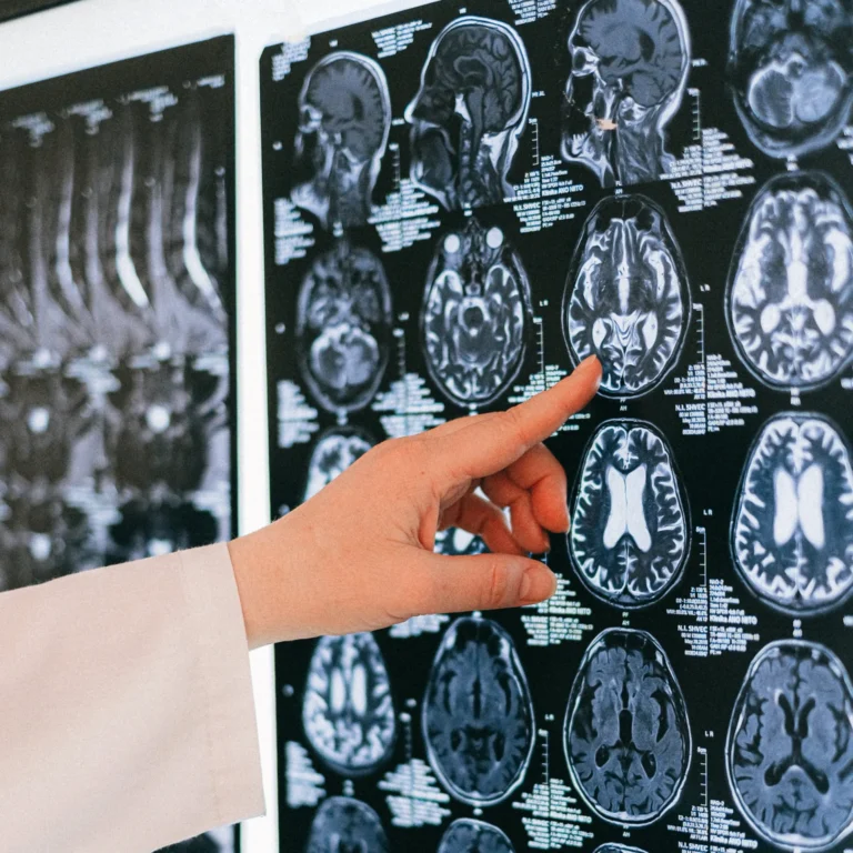 New Orleans Brain Injury Lawyer